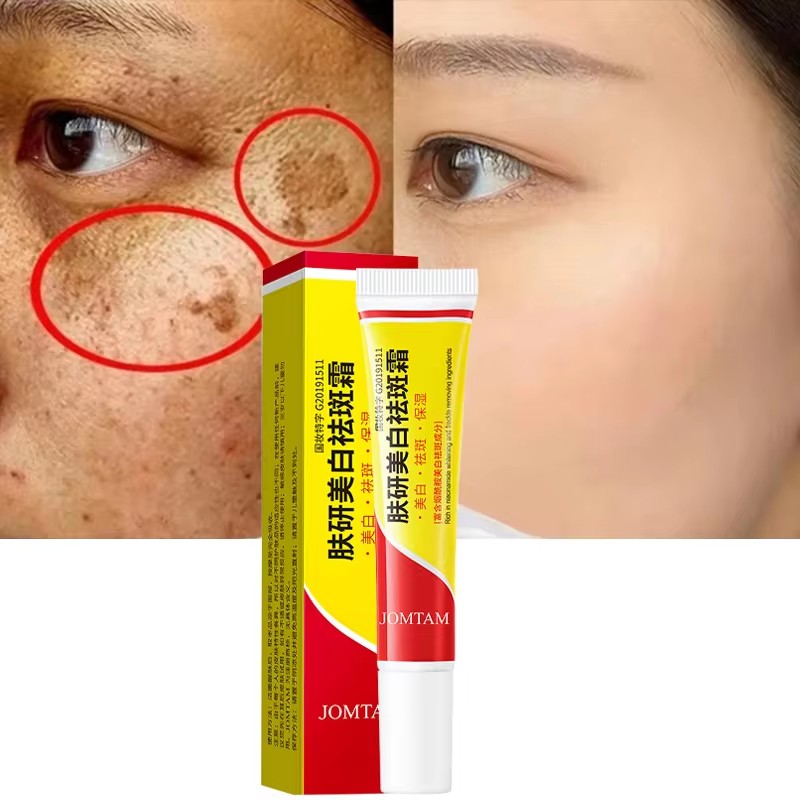 Skincare Glad2Glow - Whitening Freckle Cream Face Brightening Cream