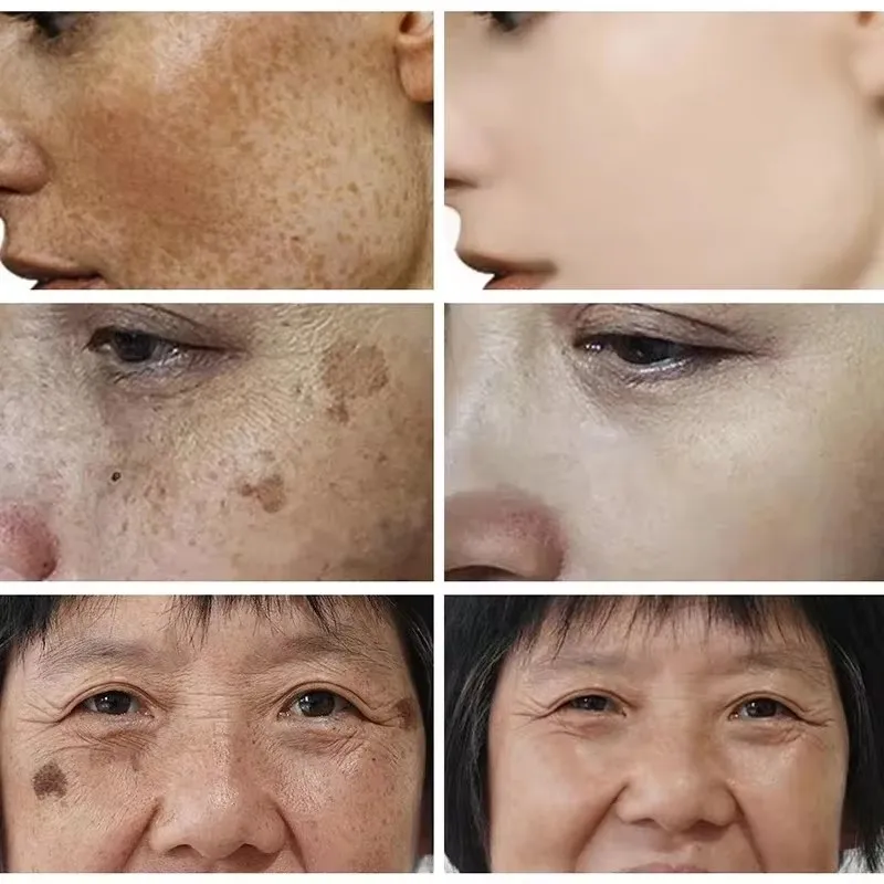 Whitening Freckle Cream Face B - Skincare Glad2Glow ulasan dan harga
