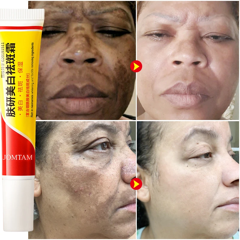 Whitening Freckle Cream Face B - Skincare Glad2Glow ulasan dan harga