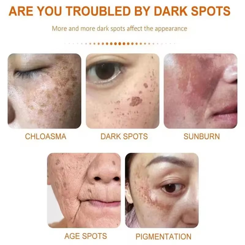 Whitening Freckle Cream Face B - Skincare Glad2Glow ulasan dan harga
