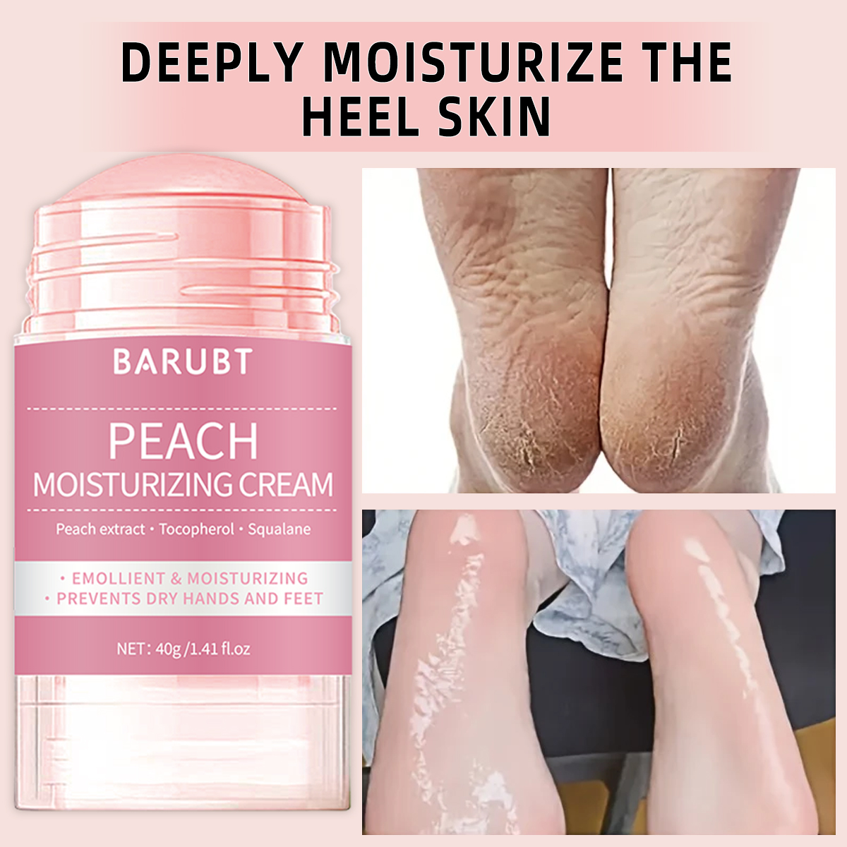 Peach urea mud film rod, salic - Urea Foot Cream ulasan dan harga
