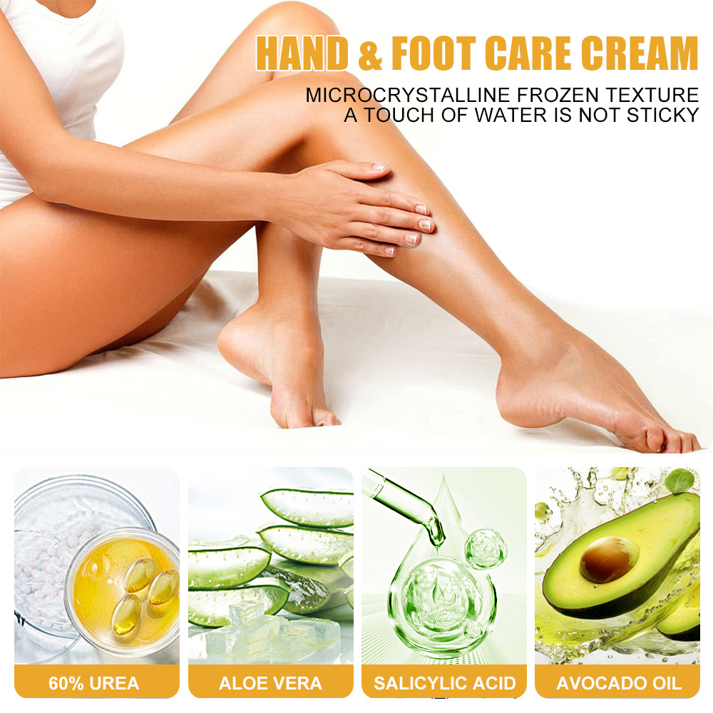 Urea Cream 60% Salicylic Acid  - Urea Foot Cream ulasan dan harga