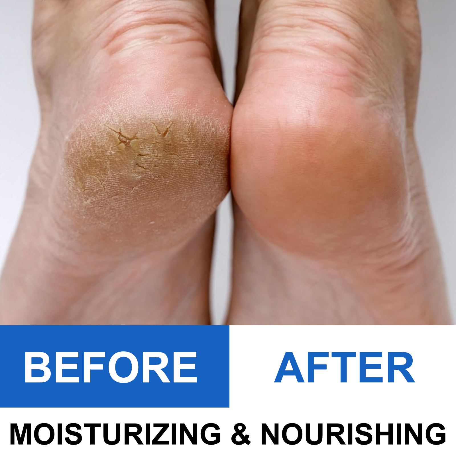 40% Urea Foot Cream Stick - Mo - Urea Foot Cream ulasan dan harga