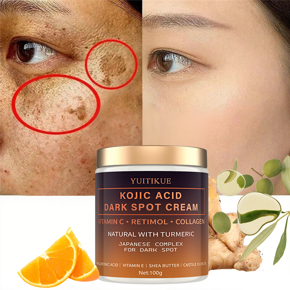 Arbutin fading cream, Vitamin  - Skincare Vitamin C ulasan dan harga