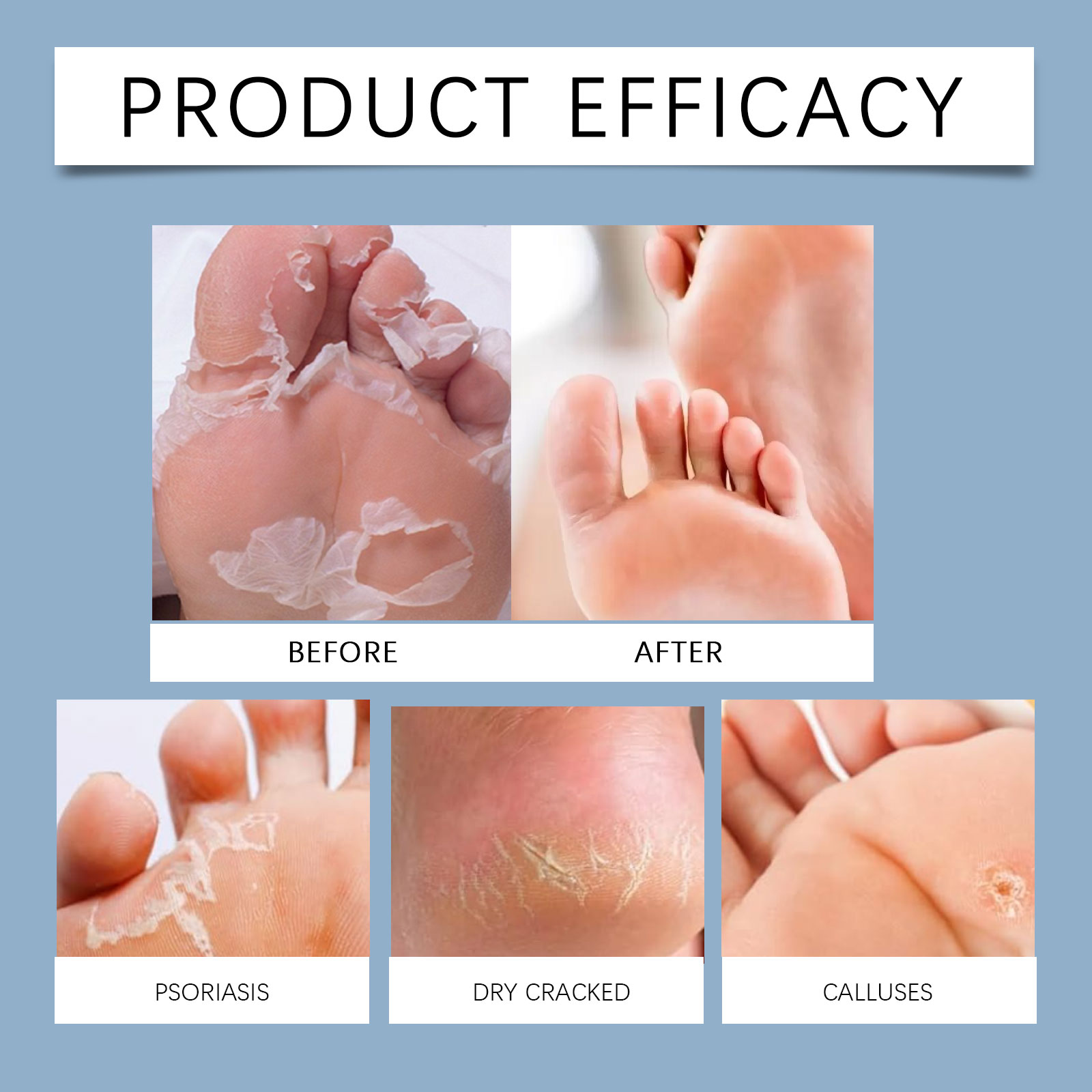 60% Urea Foot Cream Stick Mois - Urea Foot Cream ulasan dan harga